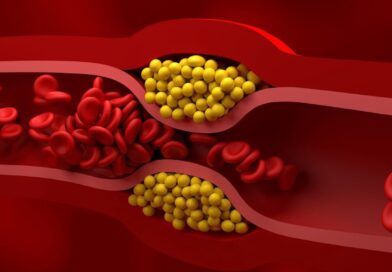 Cholesterolis – draugas ar priešas?