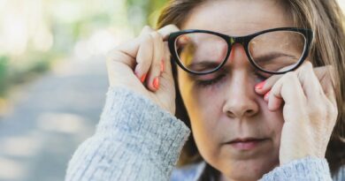 Kai išgirstame minint šią ligą, akių vokai paprastai nebūna ta vieta, kurią įsivaizduojame nuo jos nukenčiant.